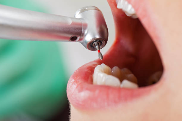 Best Emergency Dental Care for Sports Injuries in Monticello, GA